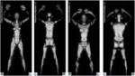 full-body-scan