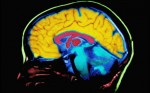 brainstudy